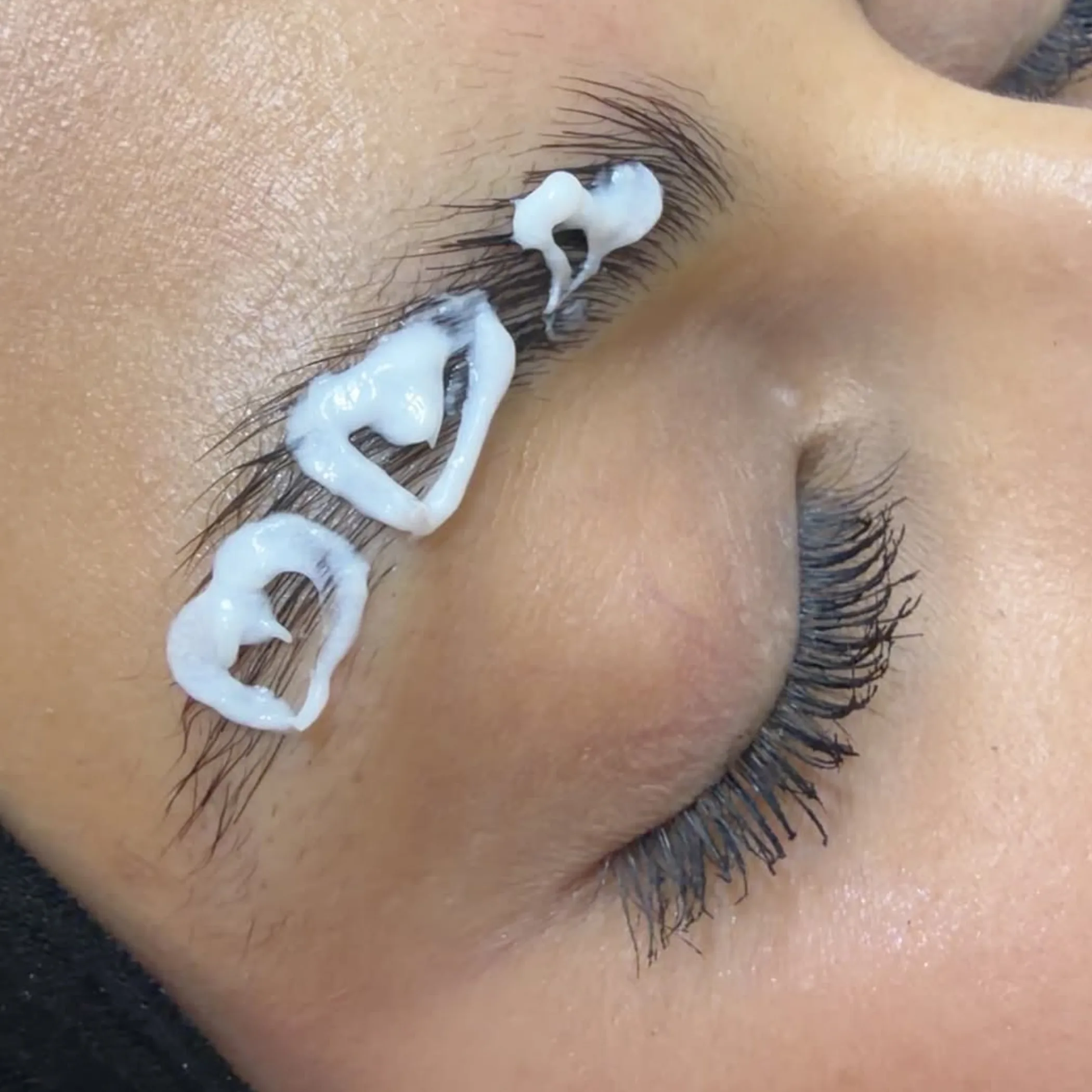 brow treatment close-up
